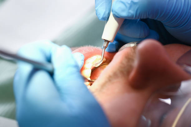 Best Emergency Tooth Extraction in Stafford Courthouse, VA