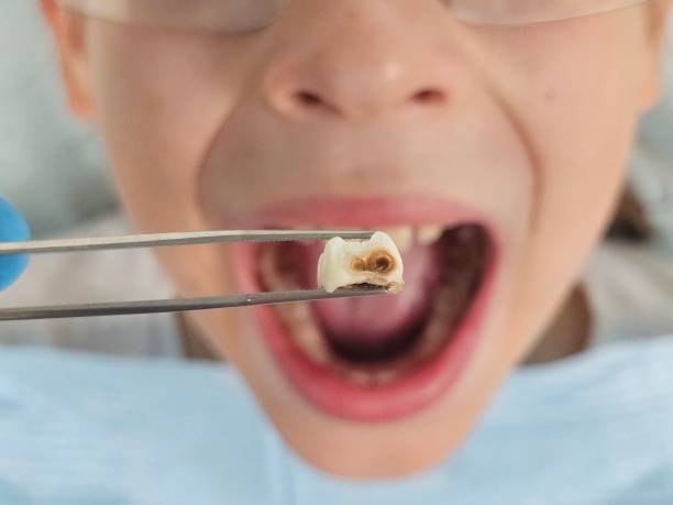 Best Same-Day Emergency Dental Services in Stafford Courthouse, VA